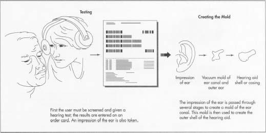 Hearing Aid