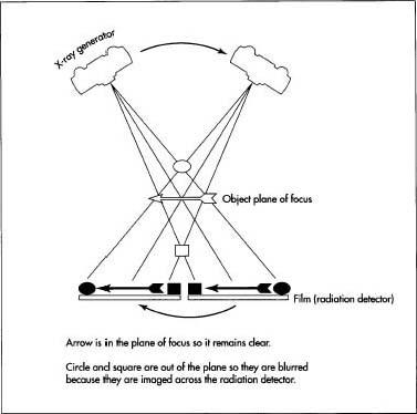 CAT scanners use X-ray technology to create three-dimensional images of the body's internal structures. Images are obtained by rotating the x-ray generator and detectors around the patient. This information is fed into a computer, which reconstructs images of the body structures within its plane of focus.