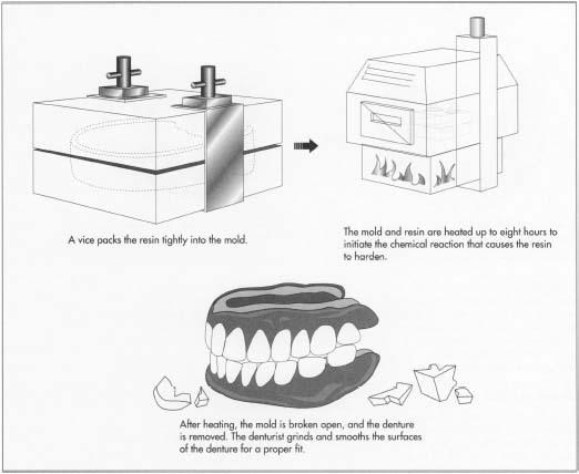 Denture