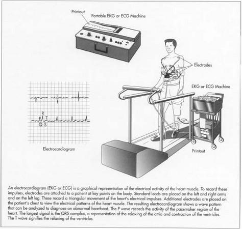 EKG Machine