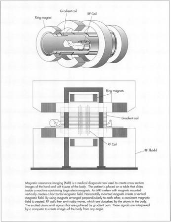 Magnetic Resonance Imaging (MRI)