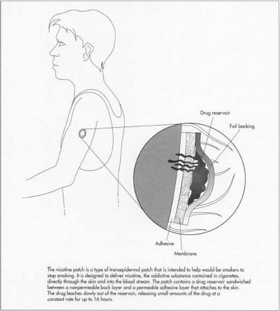 Nicotine Patch