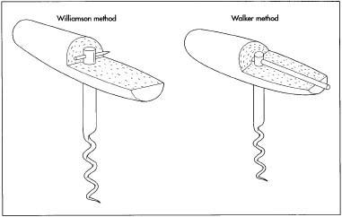 Two methods of attaching the handles to the worm.