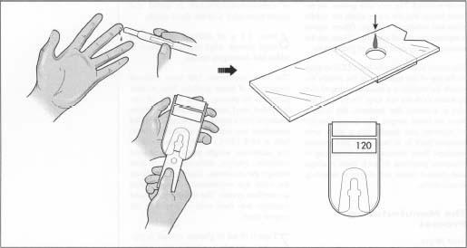 The patient pricks his finger and applies a sample to the test strip. The test strip is then inserted into the glucometer. After a period of about 10-15 seconds, the blood glucose reading appears.